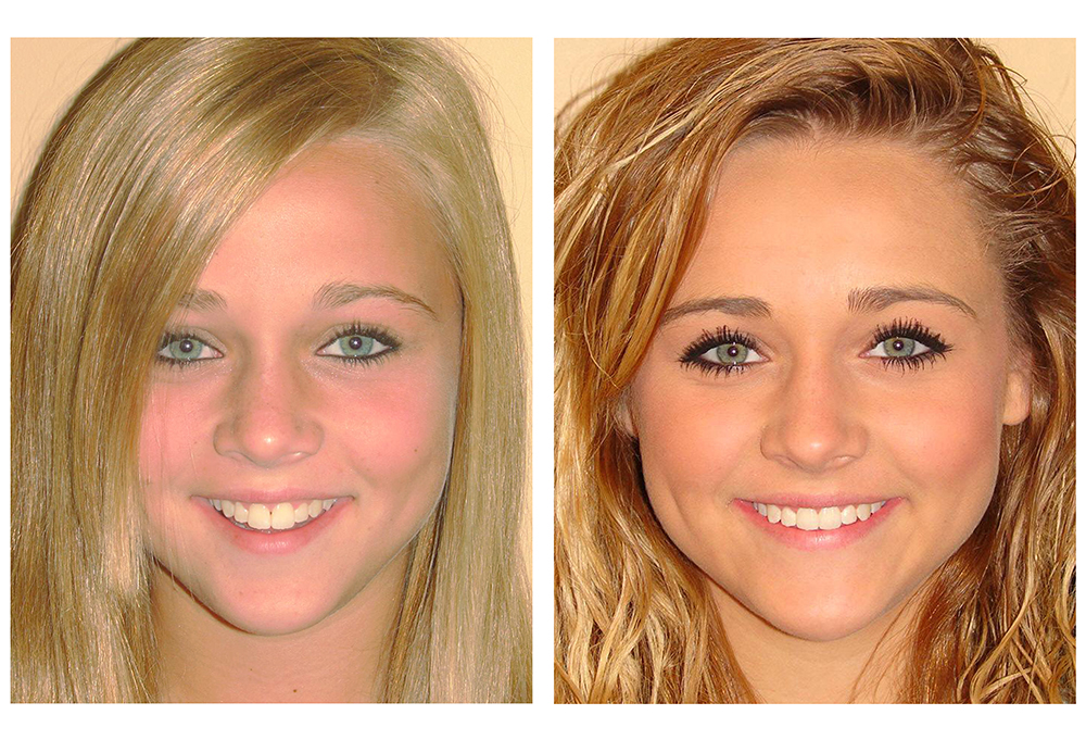 Healthy Smiles Dental Care