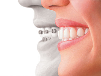 The image is a composite graphic that features two halves of smiling faces with one half showing teeth and the other not, placed together to create an illustration of dental health.