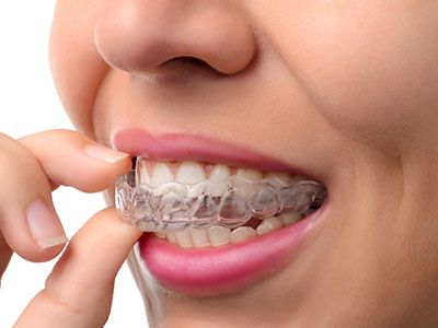 The image shows a person holding a clear retainer in their hand, with the focus on the dental appliance.